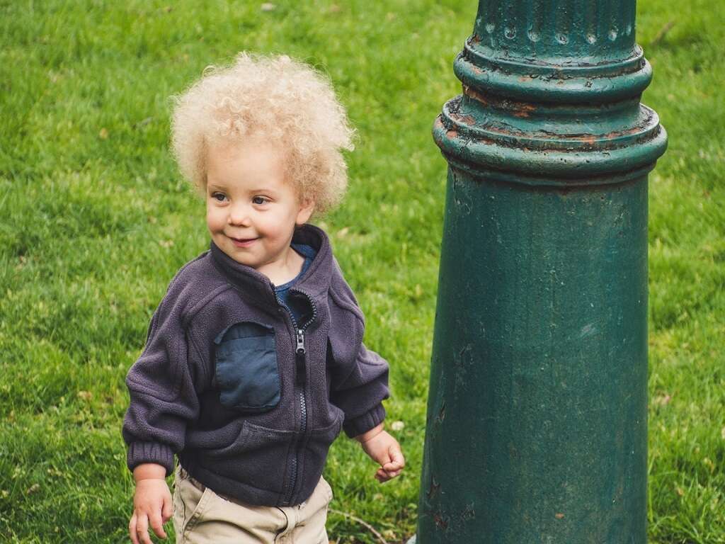 10 Uncombable Hair Syndrome FAQs