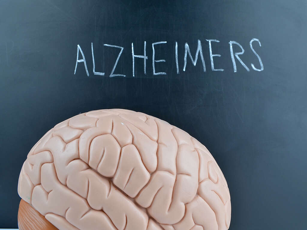 10 Alzheimer's Symptoms