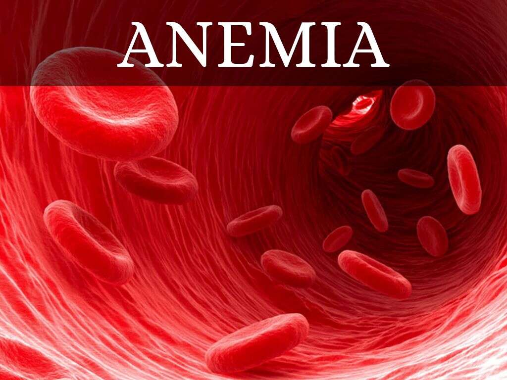 10 Symptoms of Anemia