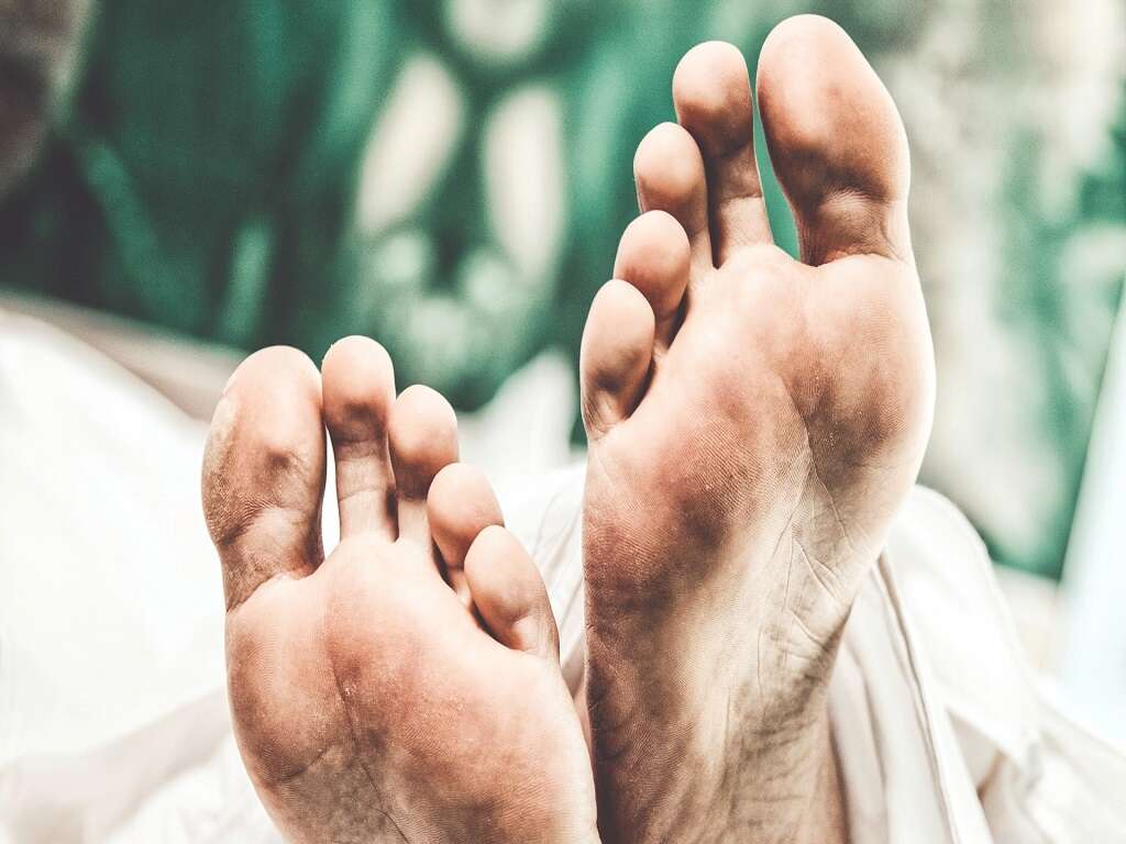 Athlete's Foot Causes, Remedies & More