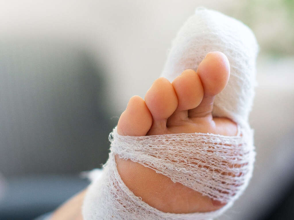 10 Broken Toe Symptoms