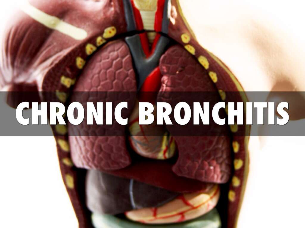 10 Bronchitis Symptoms