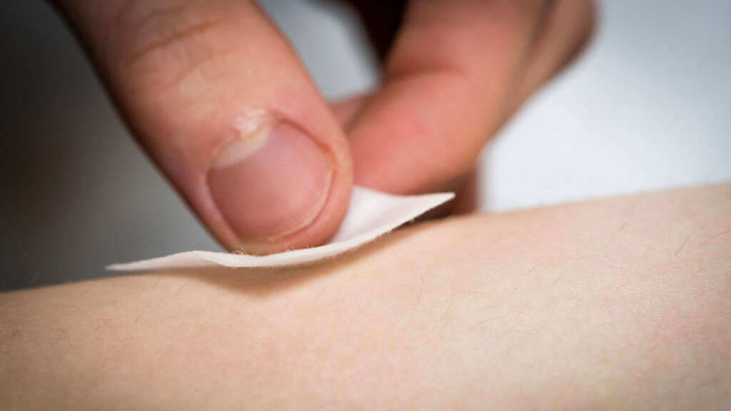 Boils 10 Causes Of Boils