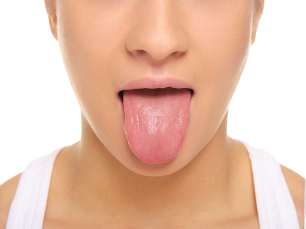 10 Causes of Dry Mouth
