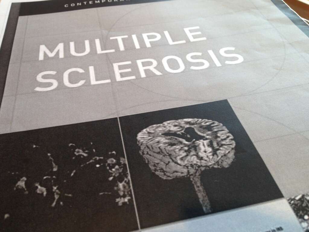 10 Symptoms of Multiple Sclerosis