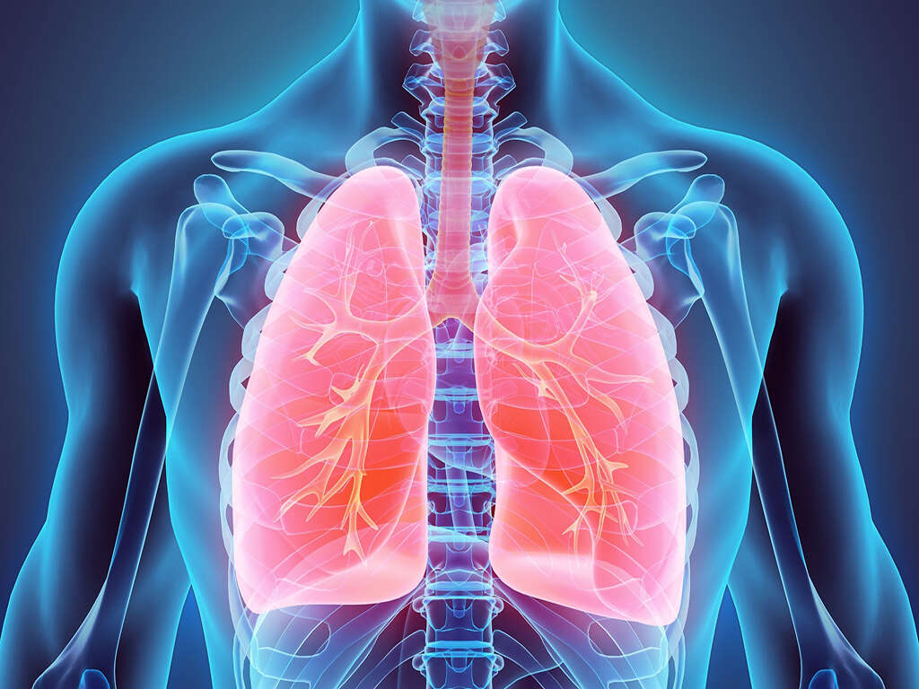10 Pulmonary Edema Symptoms