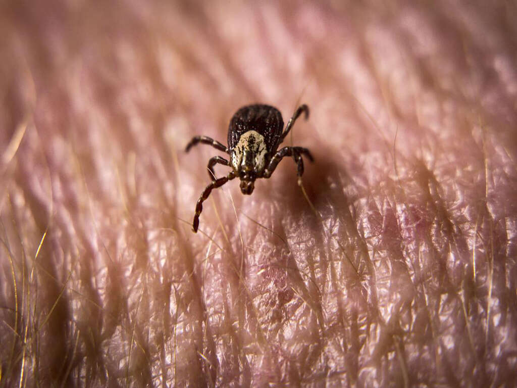 10 Symptoms of Rocky Mountain Spotted Fever