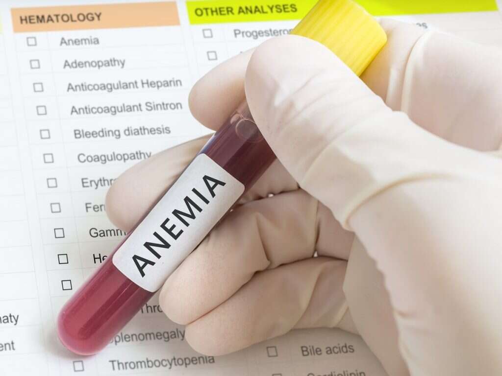 10 Signs of Anemia