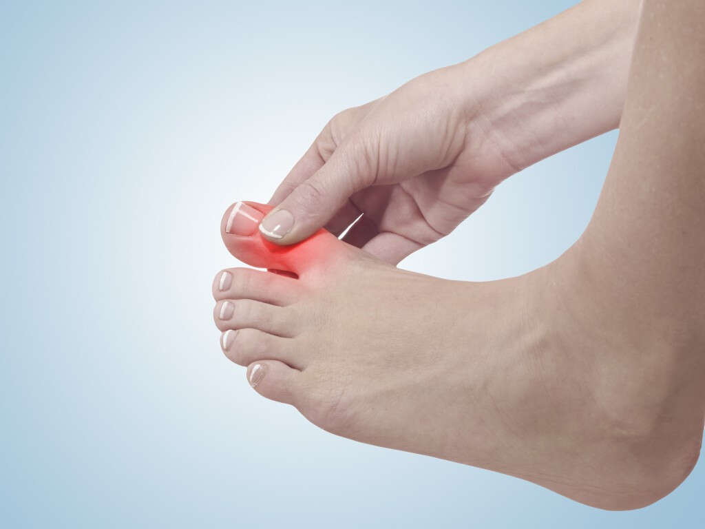 10 Symptoms of Gout in Foot