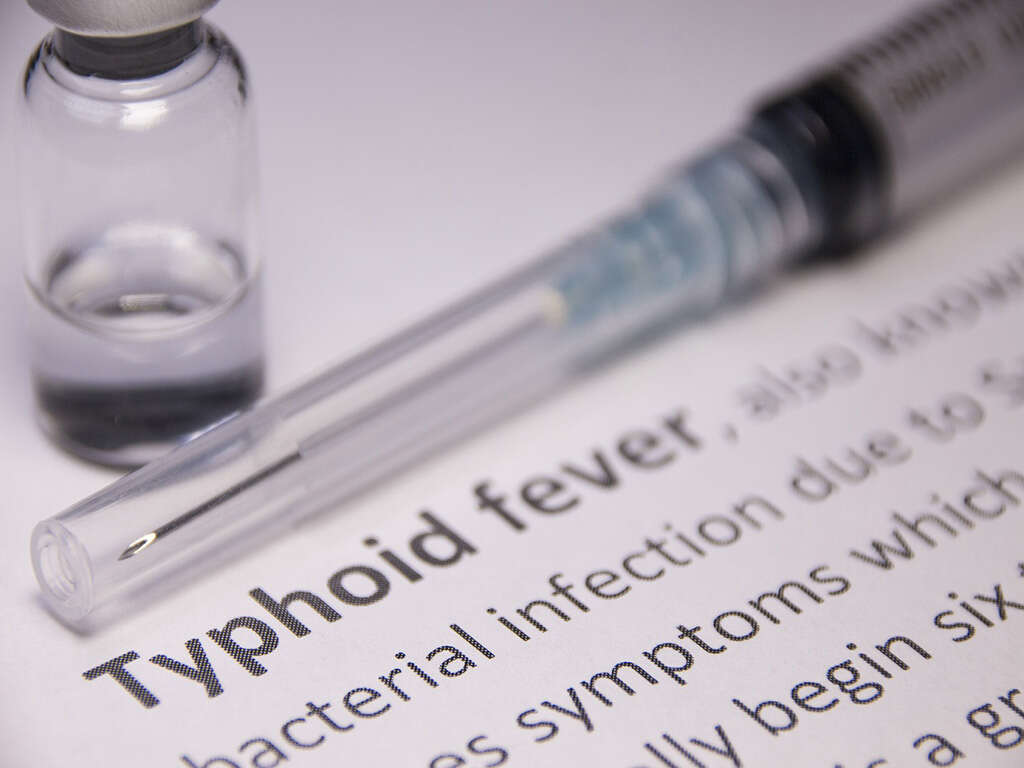 10 Symptoms of Typhoid Fever