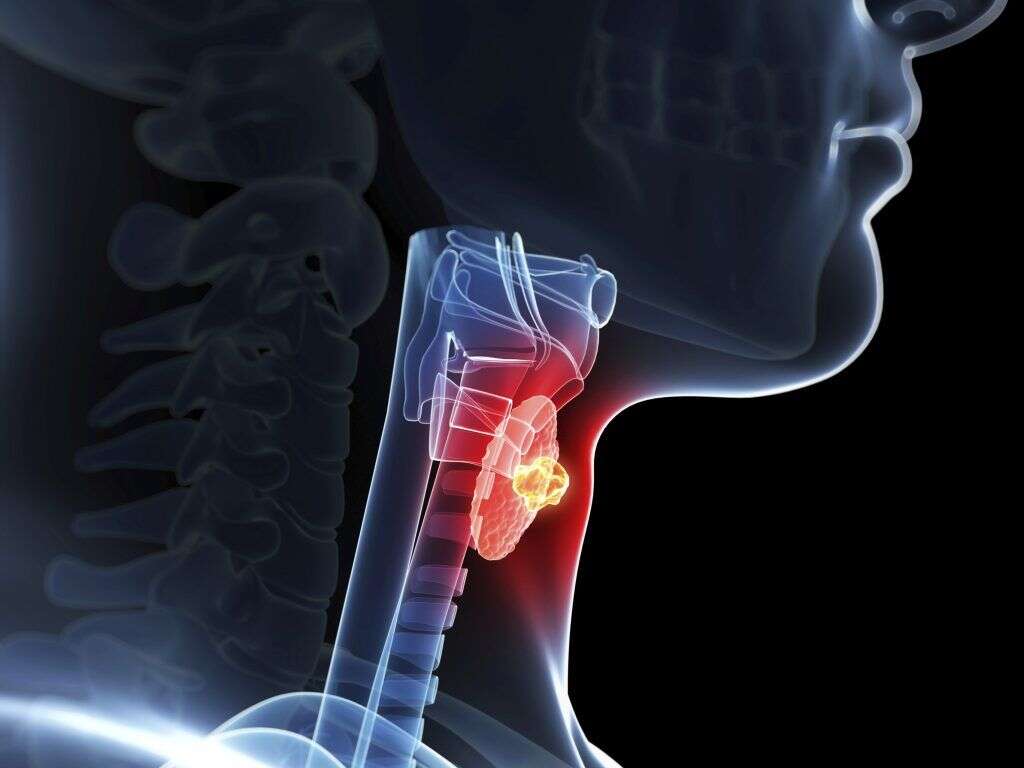 10 Underactive Thyroid Symptoms