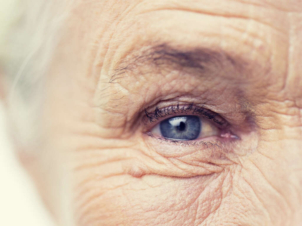 What Are Cataracts?