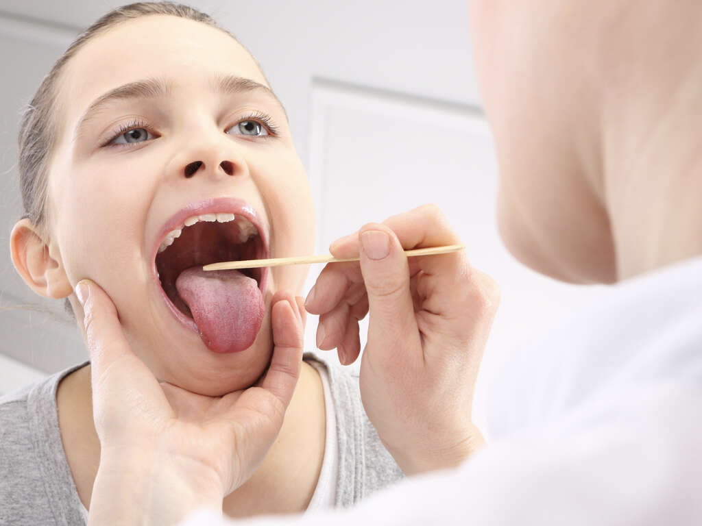 What Are White Spots On Tonsils?