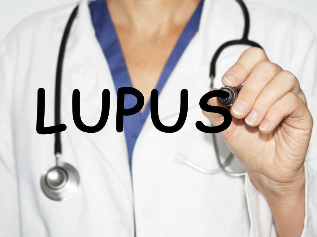 What Causes Lupus?