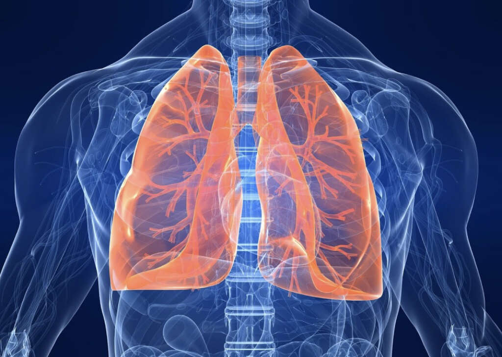 Acute Chest Syndrome