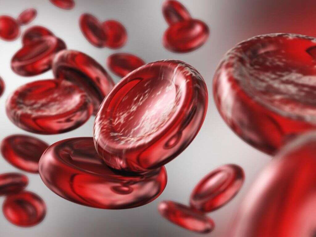 Anemia