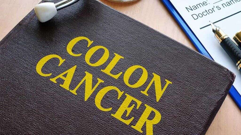 colon-cancer-what-is-colon-cancer