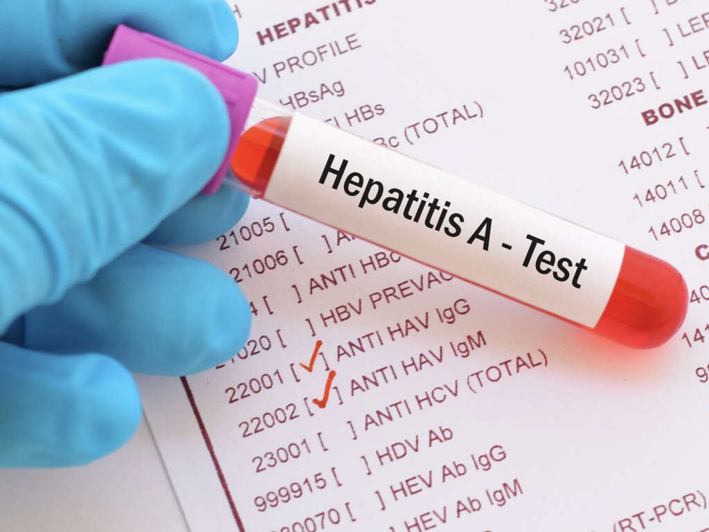 What Is Hep A?