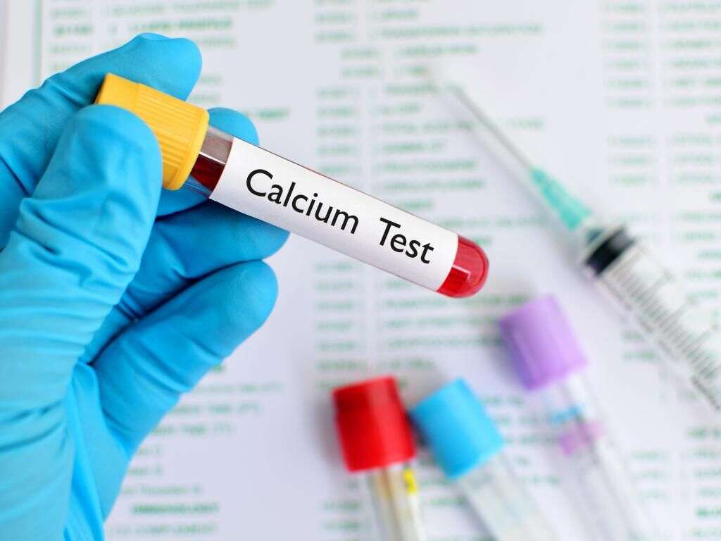What Is Hypercalcemia?