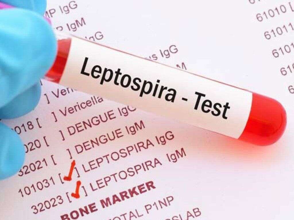 What Is Leptospirosis?