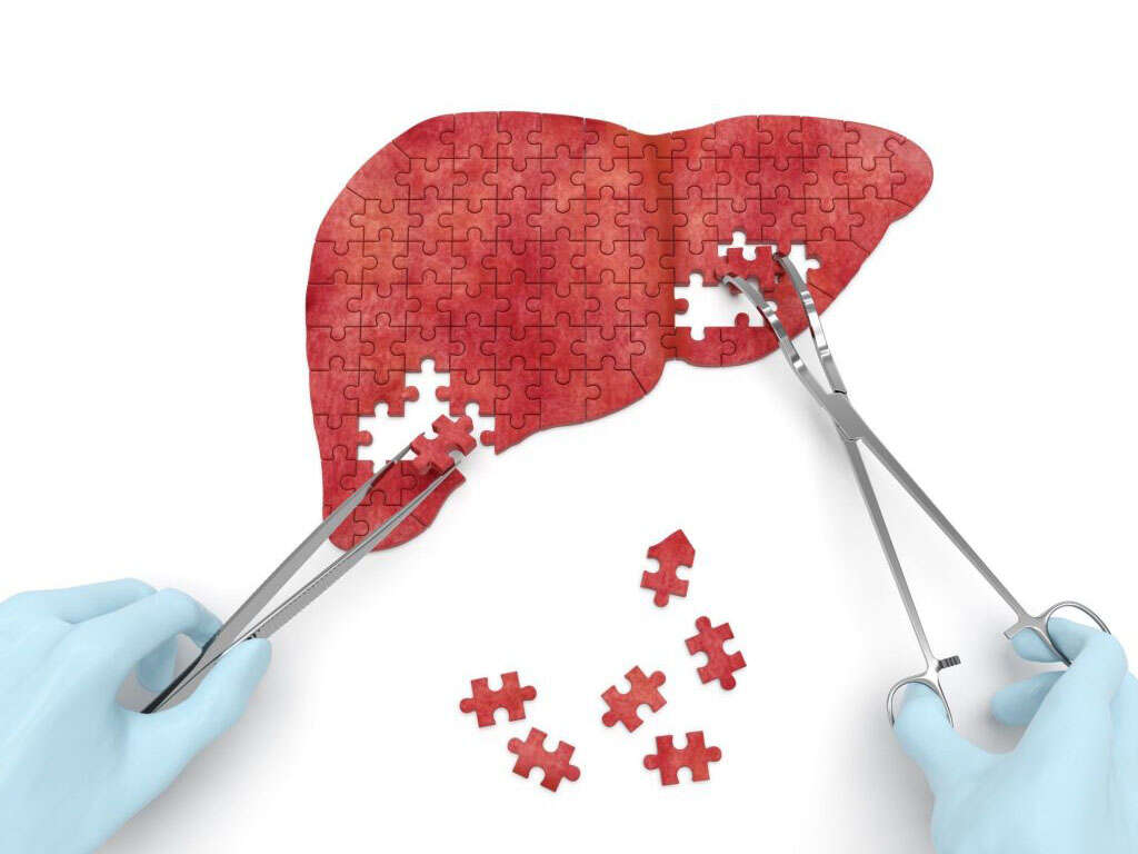 What Is Liver Failure?