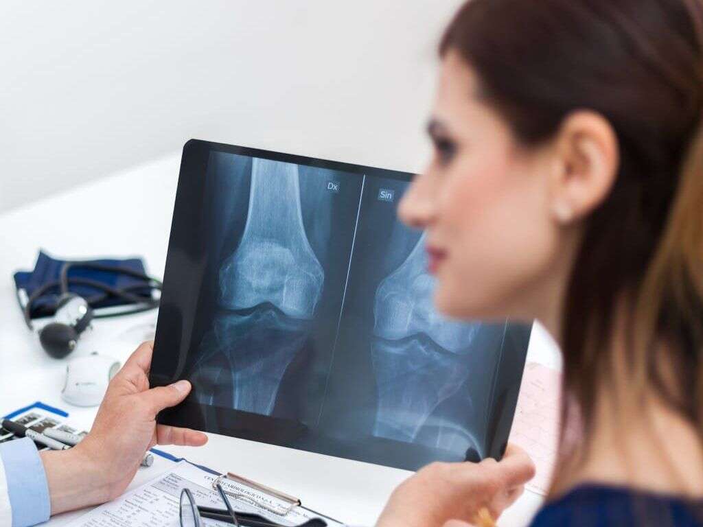 What Is Osteoporosis?