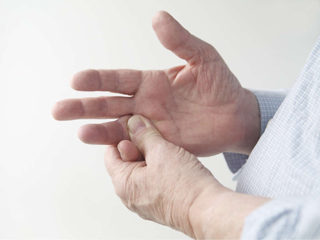 What Is Scleroderma?