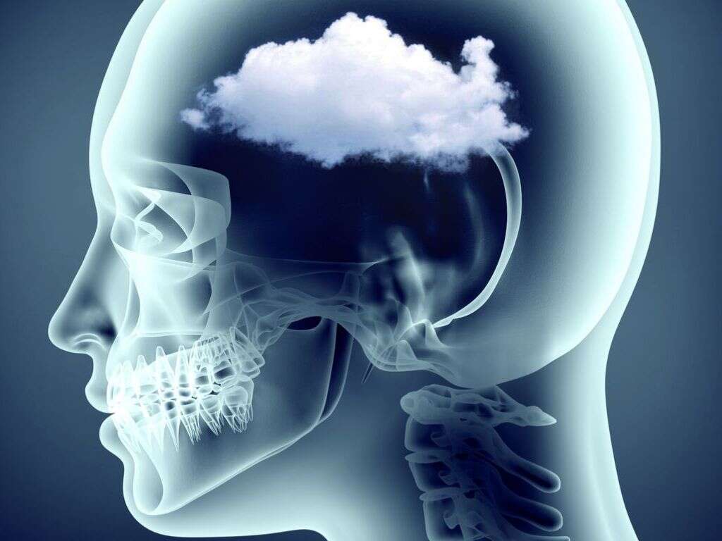 10 Causes of Brain Fog