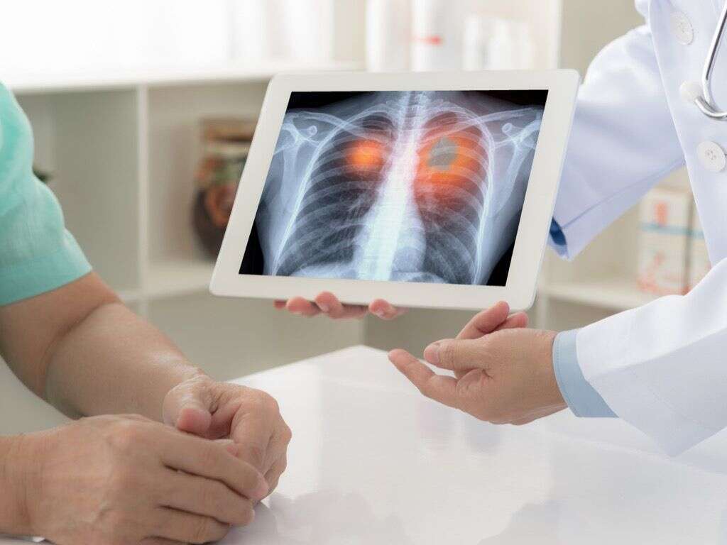 Emphysema