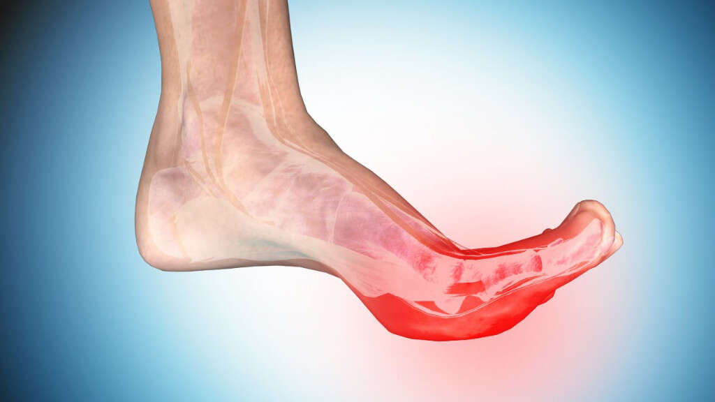 Foot Cramps 10 Causes Of Foot Cramps