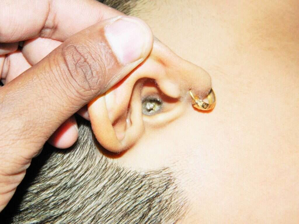 itchy-ears-inside-ear-canal-meaning-causes-allergies-treatment