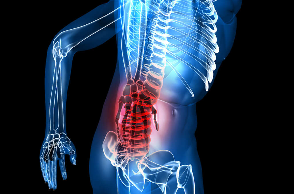 What Muscle Causes Lower Back Pain