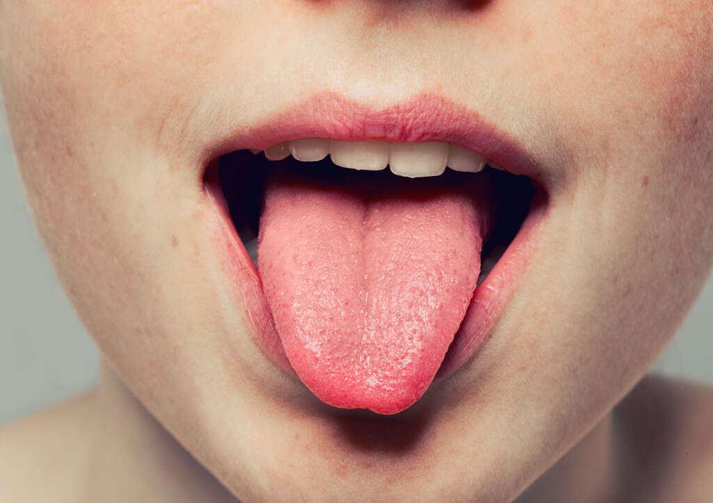 What Does A White Spot On The Tongue Mean