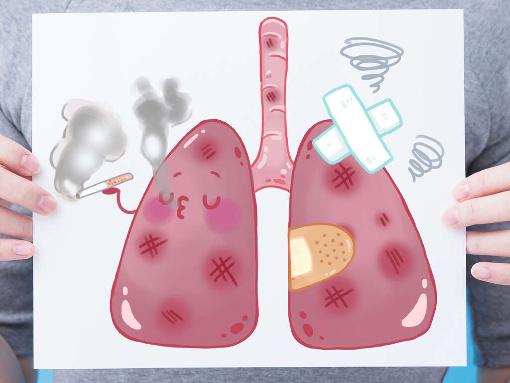 Emphysema