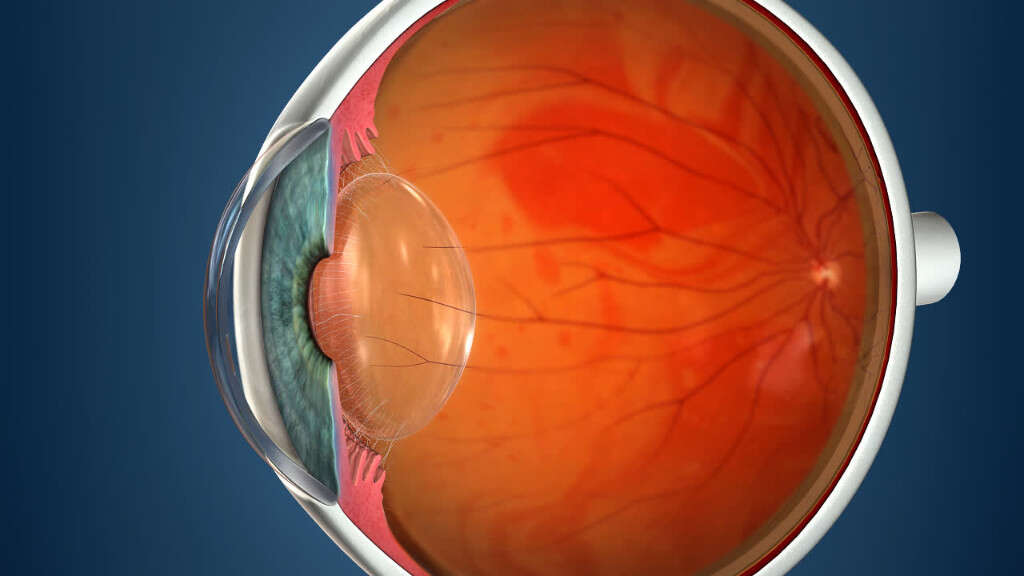 eye-floaters-10-causes-of-eye-floaters