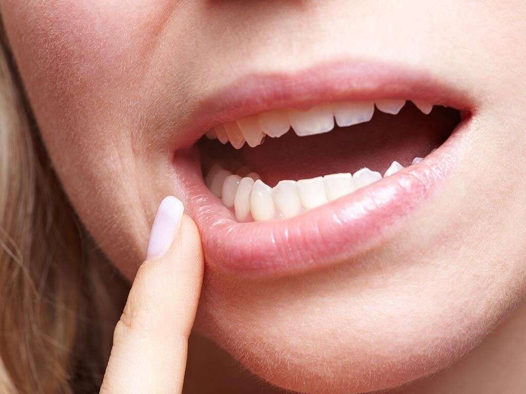 10 Gingivitis Symptoms