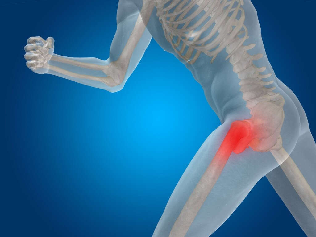 Can you walk on a fractured hip?