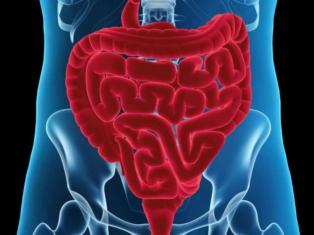 Intestinal Blockage