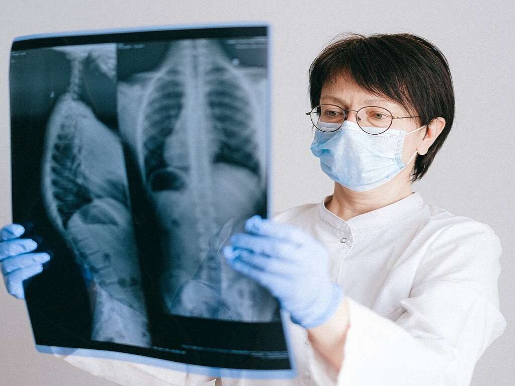 10 Osteopenia Symptoms
