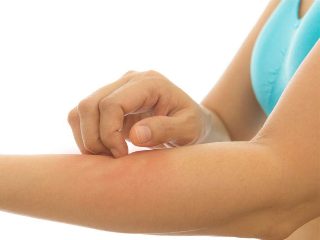 10 Pityriasis Rosea Facts