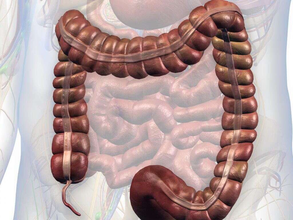 Appendicitis 10 Signs Of Appendicitis