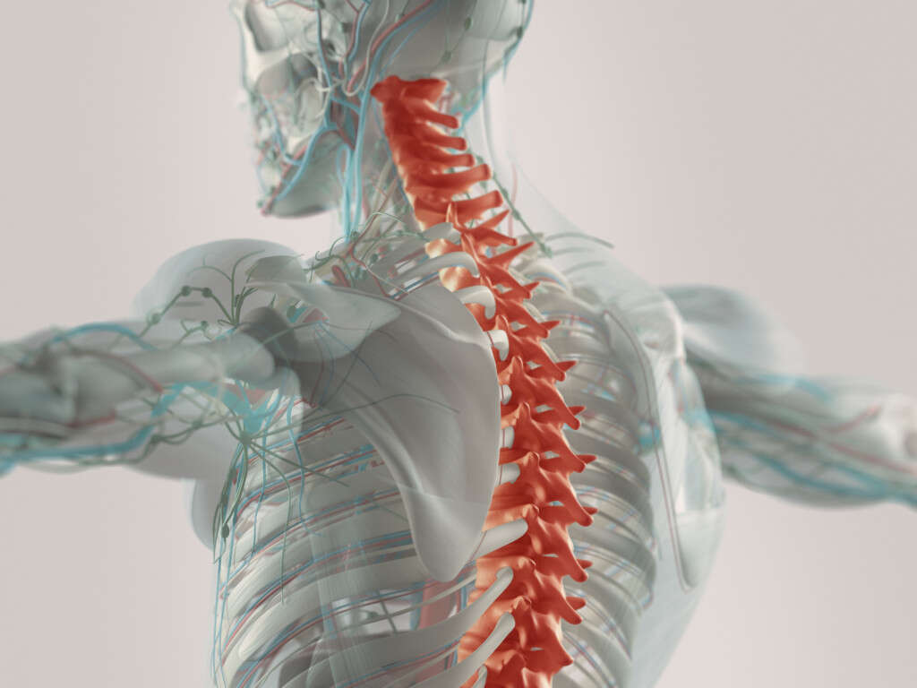 Spinal Stenosis