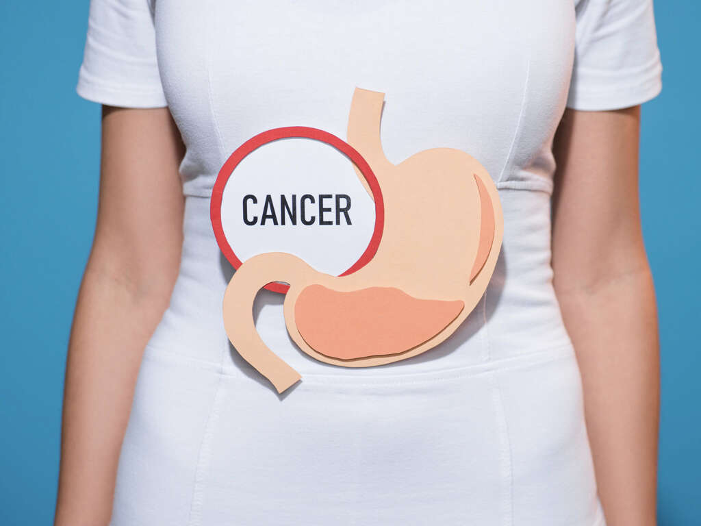 10 Signs Of Stomach Cancer