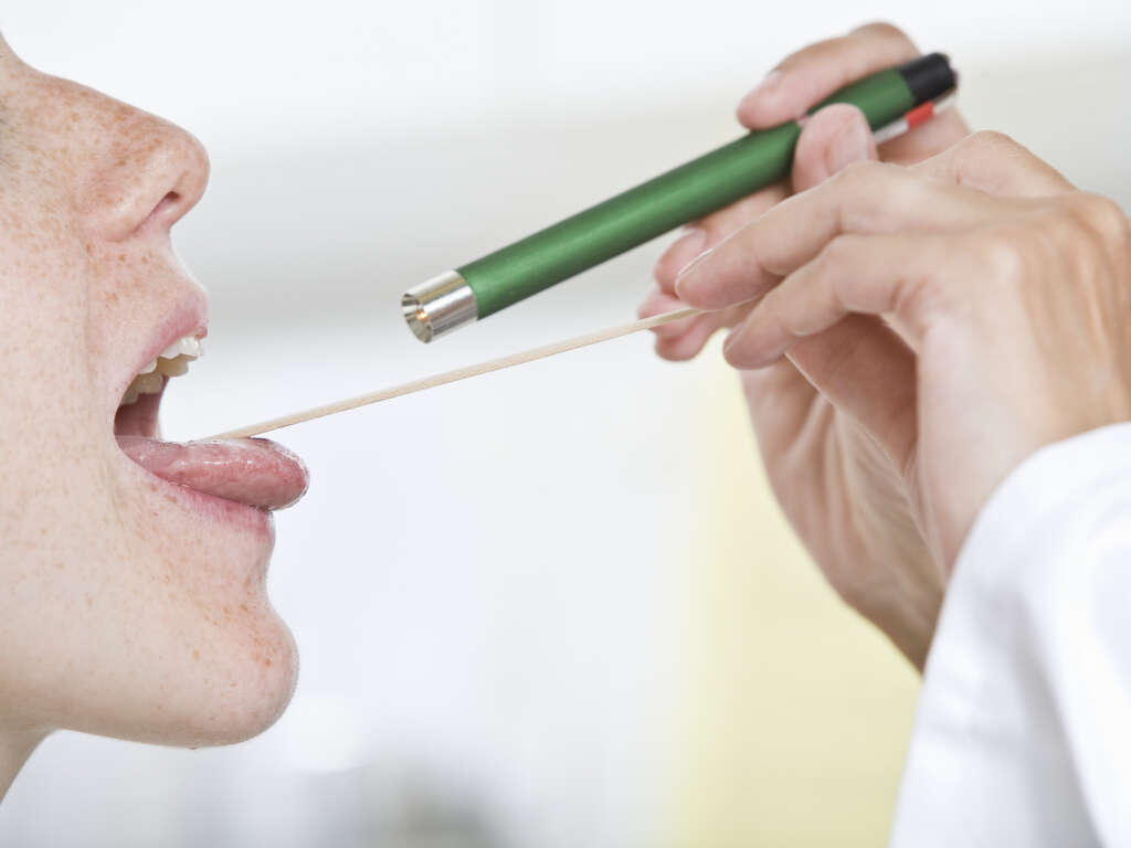 10 Strep Throat Symptoms