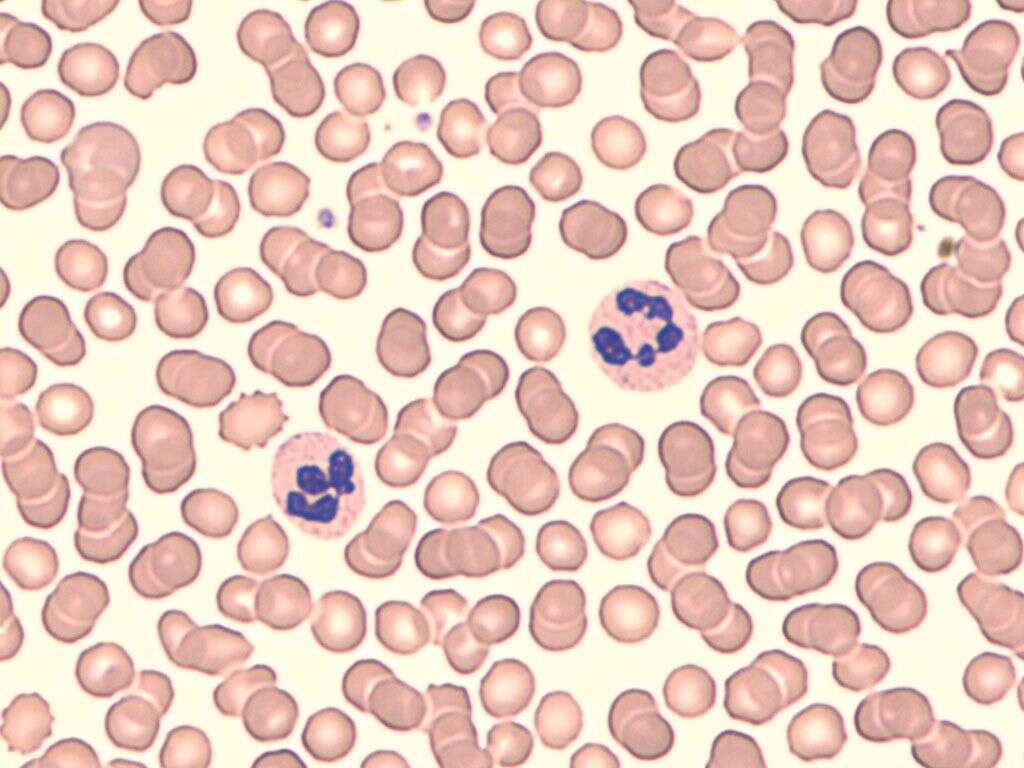 White Blood Cells