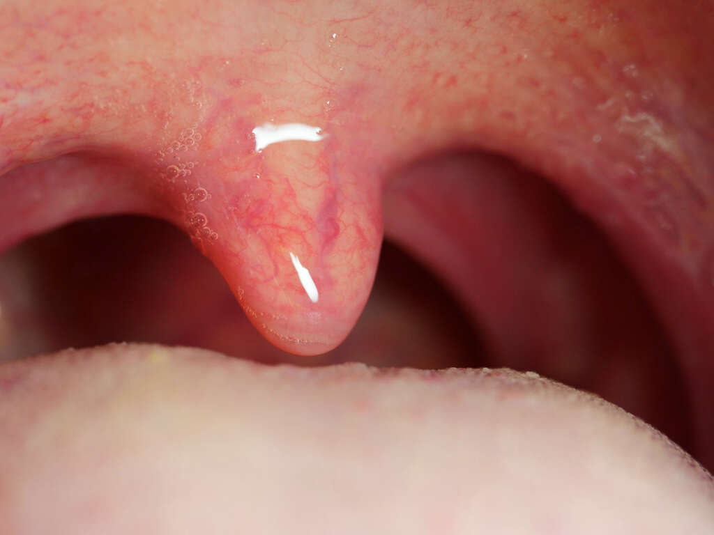 What Does the Uvula Do?