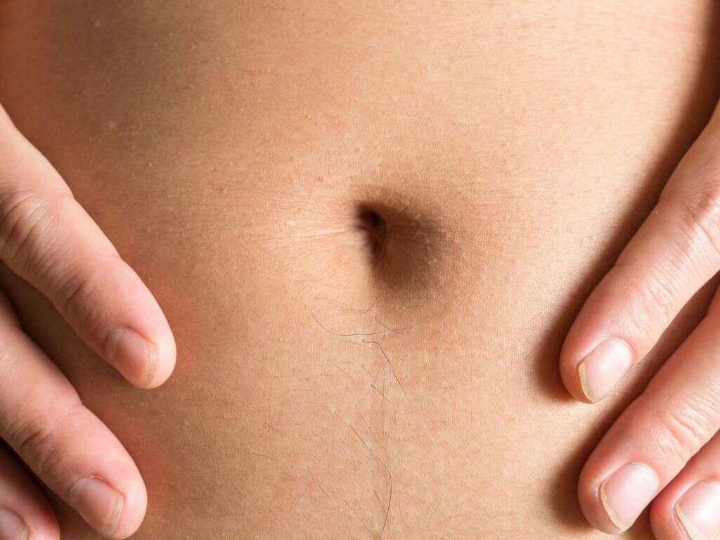 Belly Button Infection