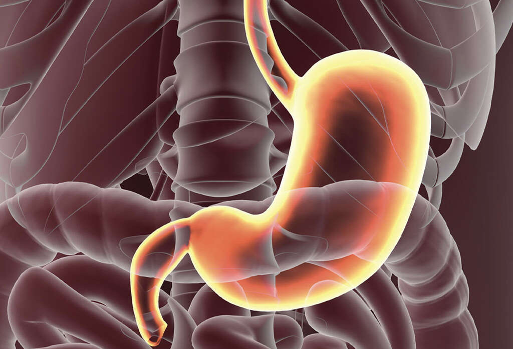 What To Do For Gastric Ulcers