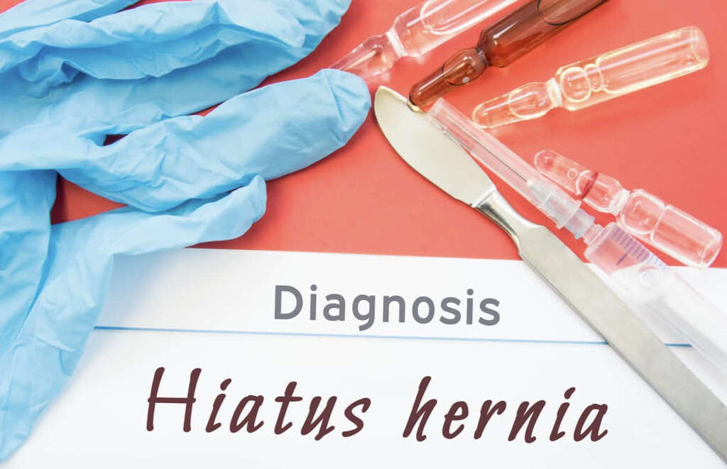 Hiatal Hernia