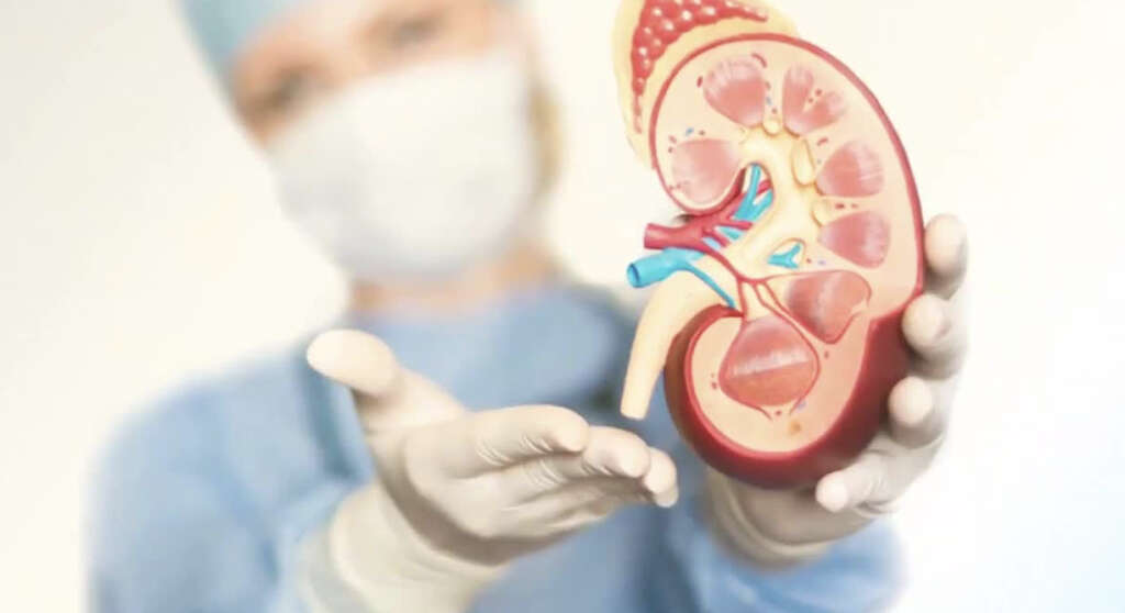 Kidney Cyst